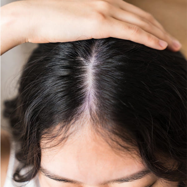 Ayurvedic Guide to Patchy Hair Loss
